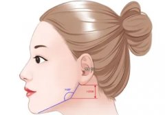 削骨手術(shù)后遺癥有哪些？多少錢?必看指南！